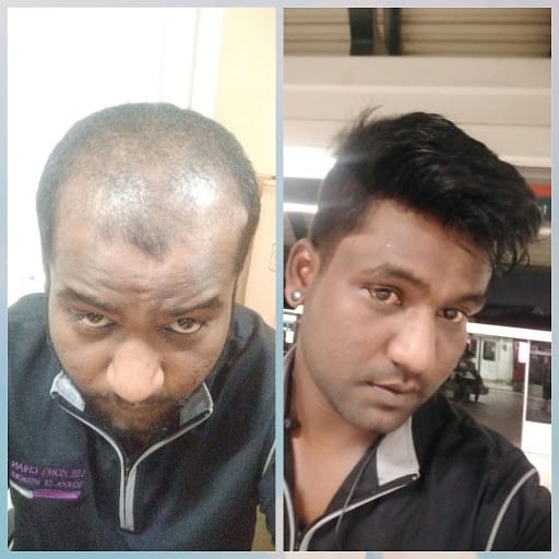 Haireal Hair Replacement