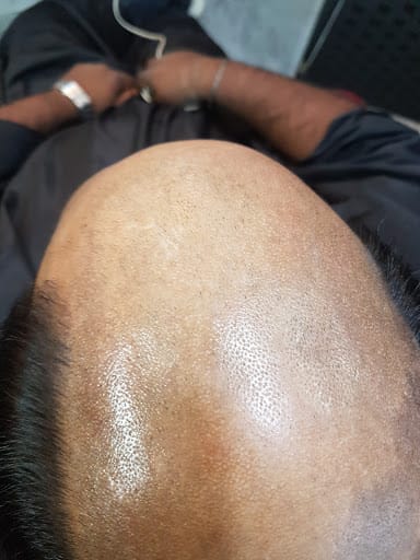 Haireal Hair Replacement