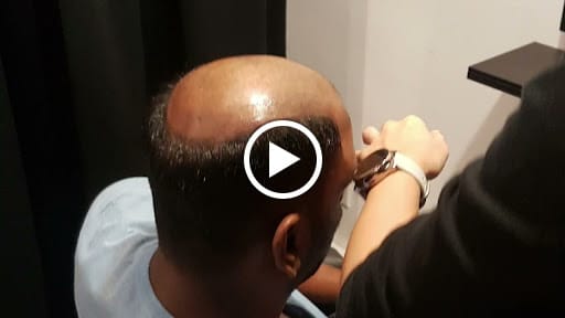 Haireal Hair Replacement