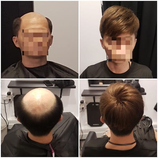 Haireal Hair Replacement