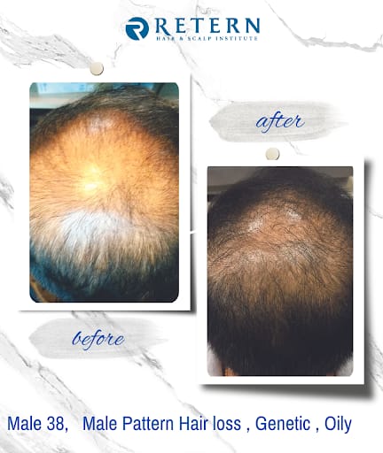 Retern Hair & Scalp Institute