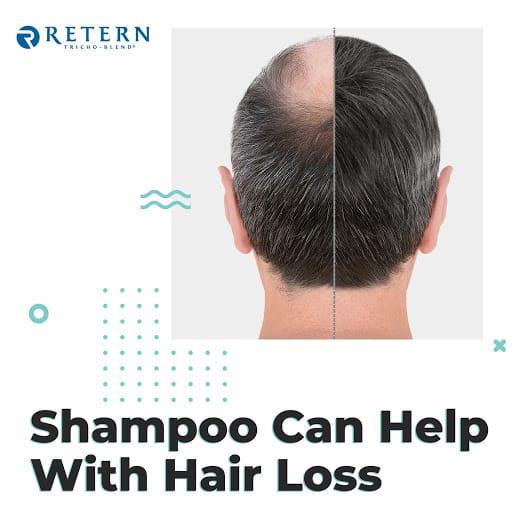 Retern Hair & Scalp Institute