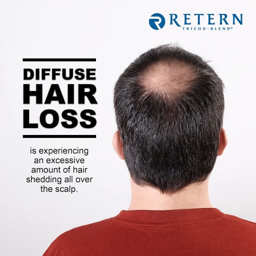 Retern Hair & Scalp Institute