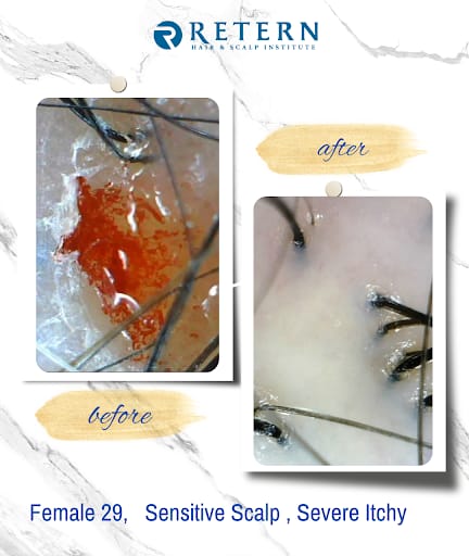Retern Hair & Scalp Institute
