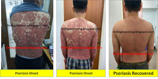 Eastern Healing TCM Clinic