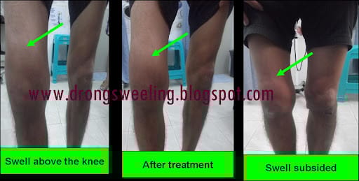 Eastern Healing TCM Clinic