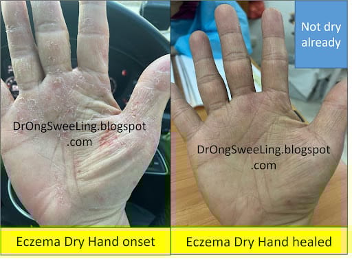 Eastern Healing TCM Clinic