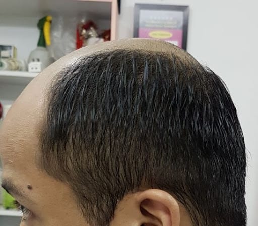 Haireal Hair Replacement