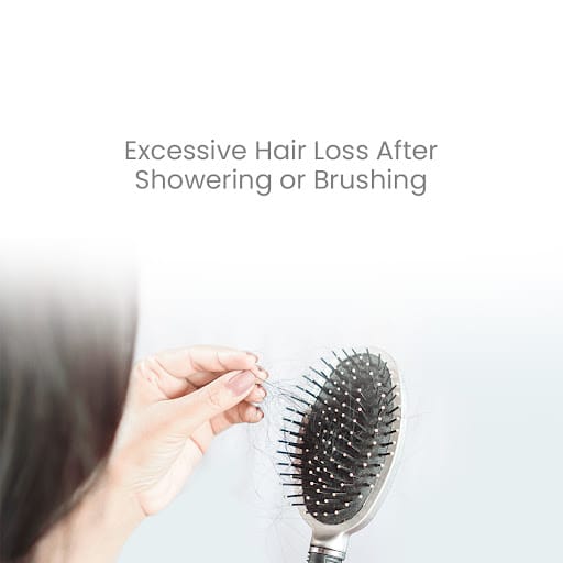 Retern Hair & Scalp Institute