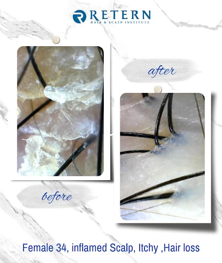 Retern Hair & Scalp Institute