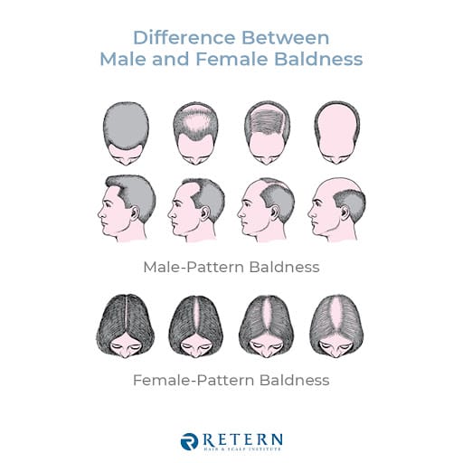 Retern Hair & Scalp Institute