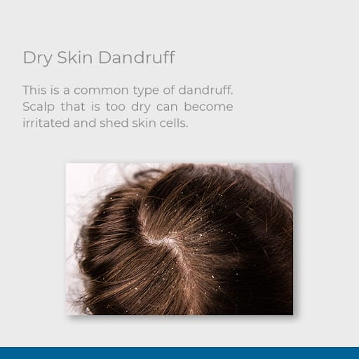 Retern Hair & Scalp Institute