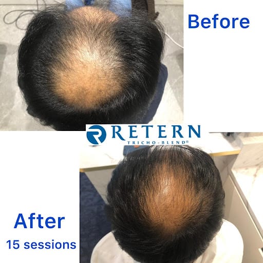 Retern Hair & Scalp Institute