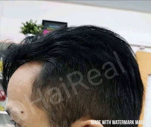 Haireal Hair Replacement