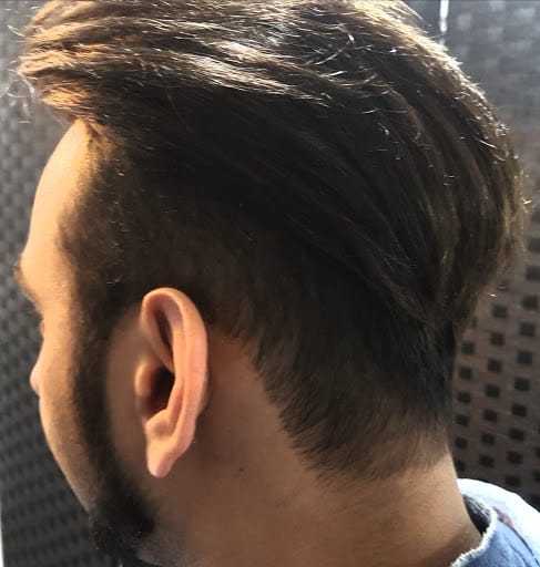 Haireal Hair Replacement