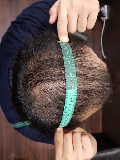 Haireal Hair Replacement