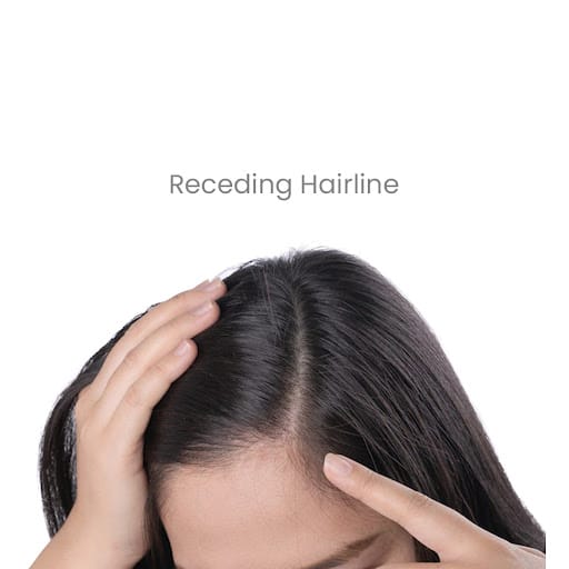 Retern Hair & Scalp Institute