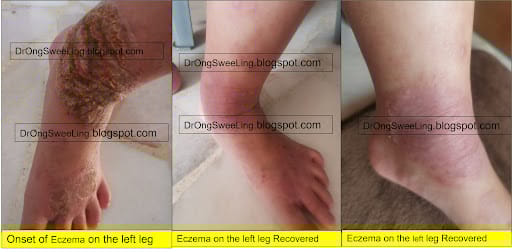 Eastern Healing TCM Clinic