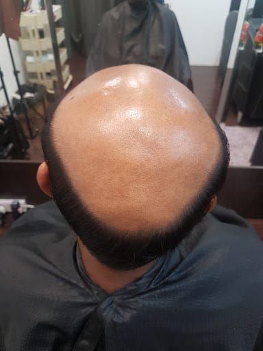 Haireal Hair Replacement