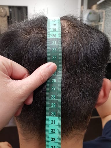 Haireal Hair Replacement