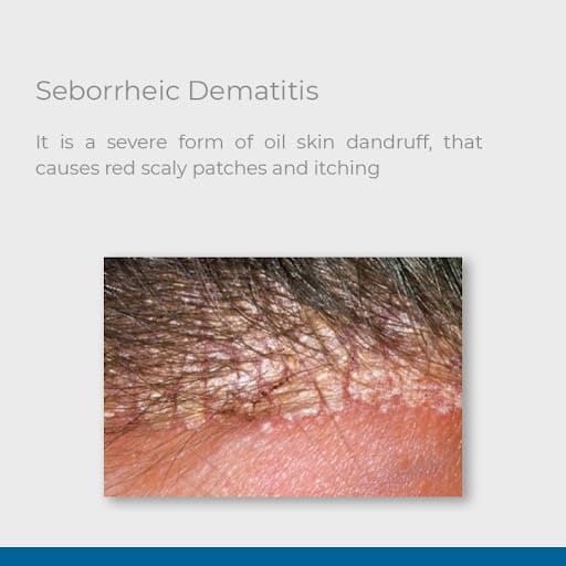 Retern Hair & Scalp Institute