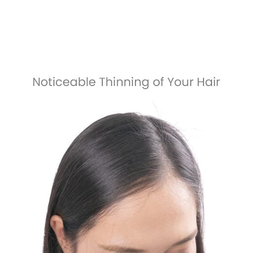 Retern Hair & Scalp Institute