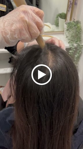 Retern Hair & Scalp Institute