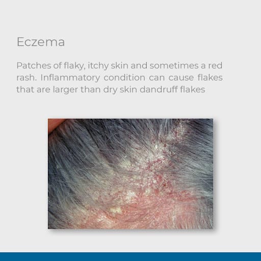 Retern Hair & Scalp Institute