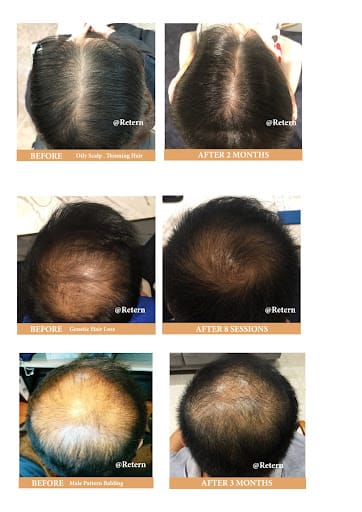 Retern Hair & Scalp Institute