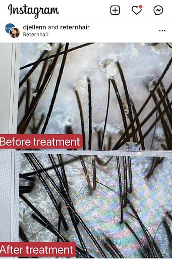 Retern Hair & Scalp Institute