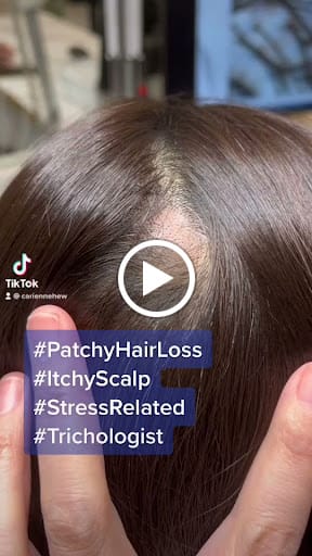 Retern Hair & Scalp Institute