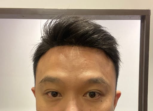 Rehair Lab Singapore - Hair Replacement System For Men