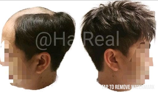 Haireal Hair Replacement