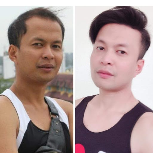 Haireal Hair Replacement